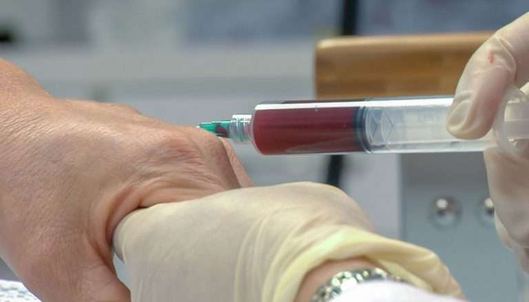 prp-platalet-rich-plasma