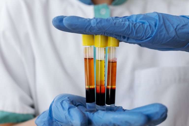 4 things dr. javier placer can teach us about prp procedure
