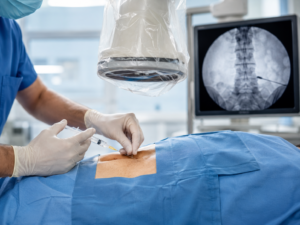 Epidural Steroid Injection Safety: What to Know